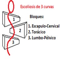 Pilates - Escoliosis de 3 curvas