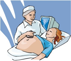 La neumonía y el embarazo
