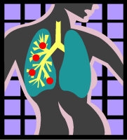 ¿Conocés tu capacidad pulmonar?
